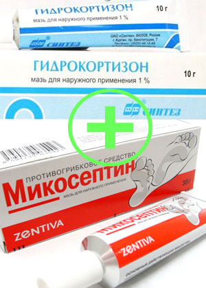 Опрелости в паху у мужчин и женщин: как лечить, отчего возникаю опрелости у взрослых, способы лечения недуга