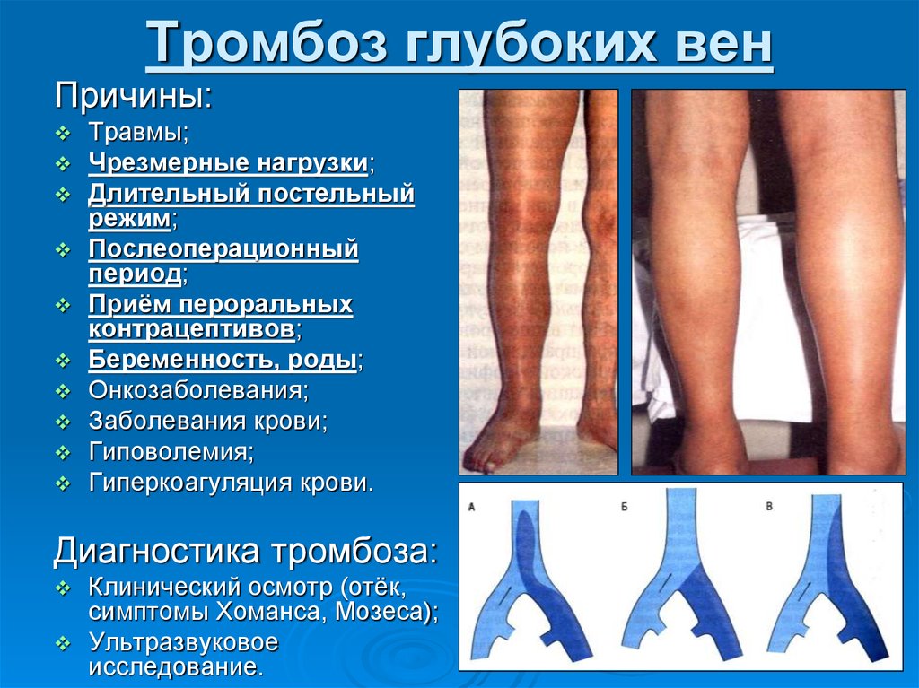 Некроз – причины болезни, симптомы и виды некрозов