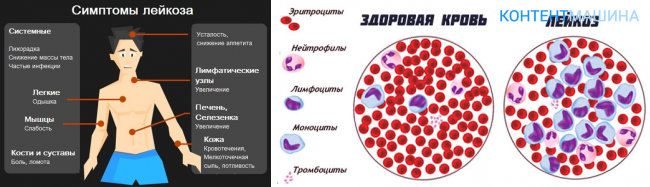 Костный мозг