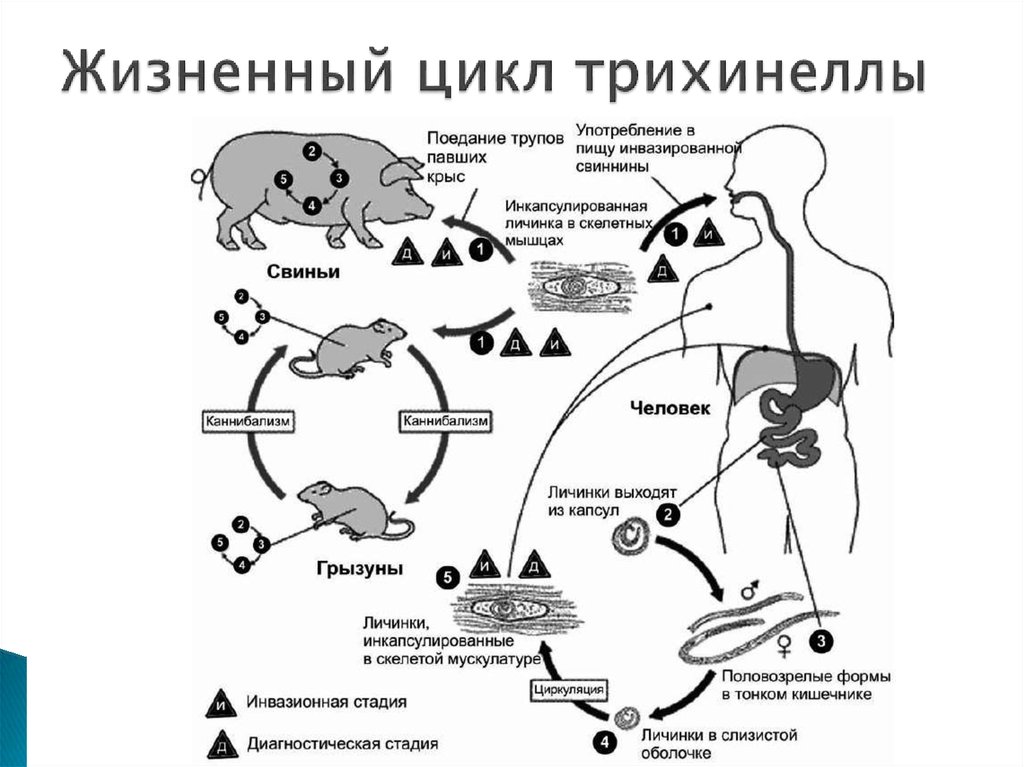 Трихинеллез | университетская клиника