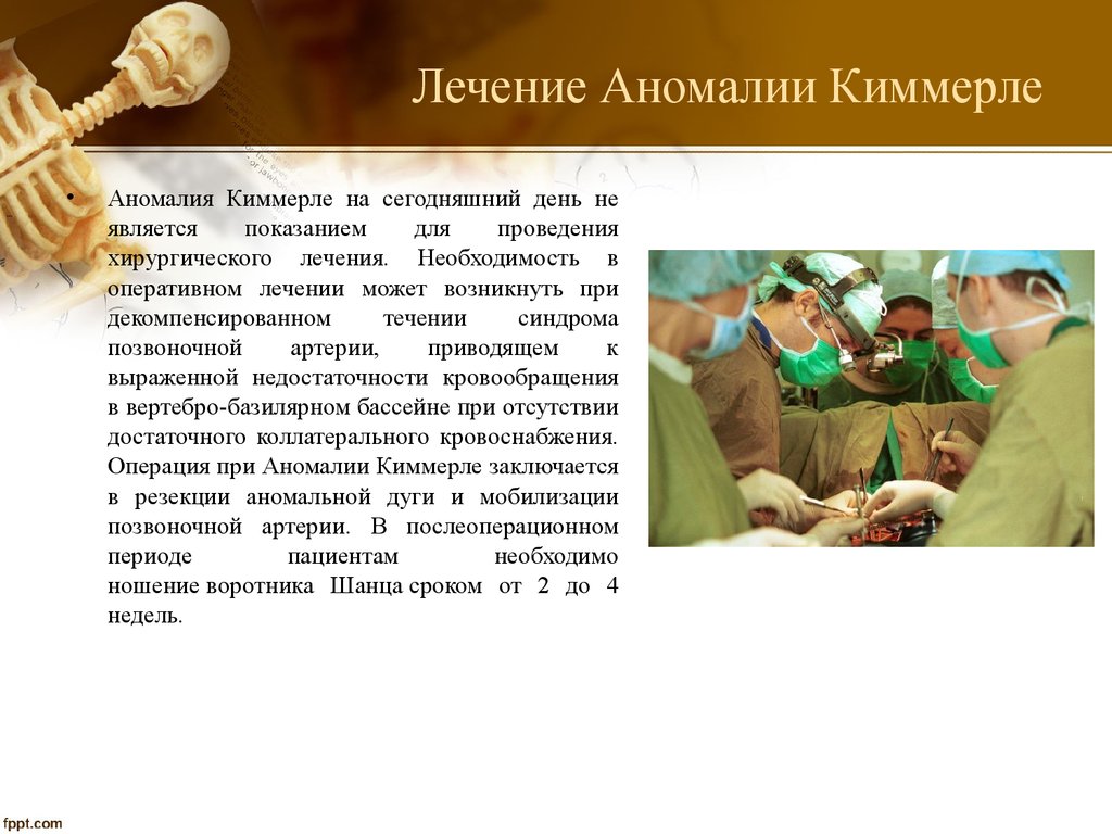 Аномалия киммерле в шейном отделе позвоночника что это за синдром, какие симптомы, диагностика и лечение, код по мкб 10