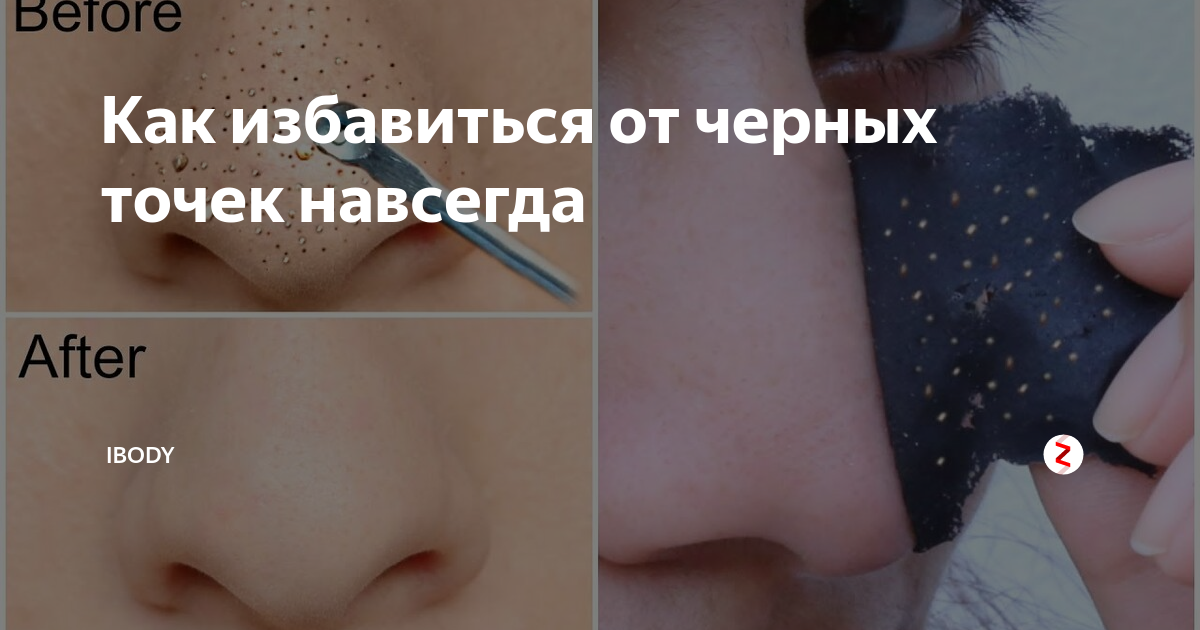Поры на лице – как очистить и сохранить чистоту кожи? [100% эффект]