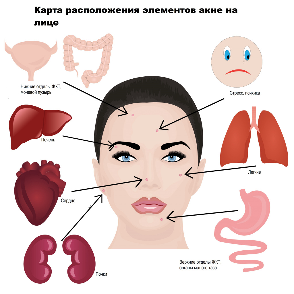 Примета: прыщ на переносице (у женщин, мужчин) | fortunamag