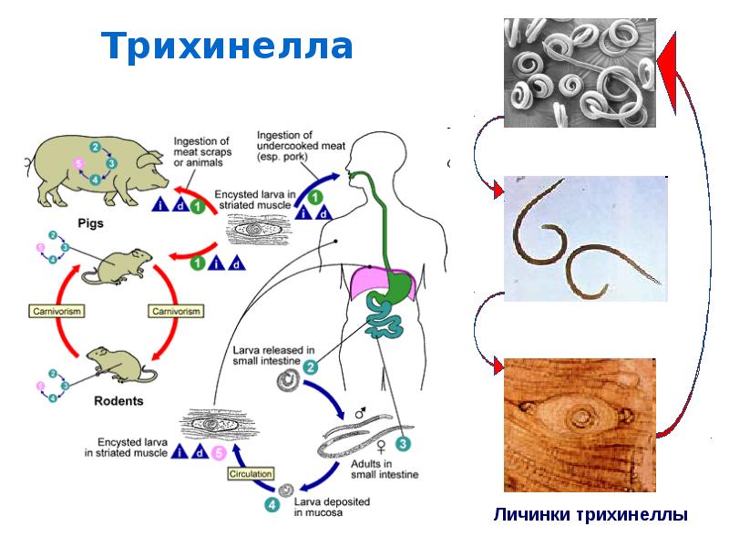Трихинелла жизненный цикл | болезнь паркинсона