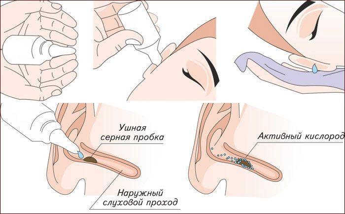 Пульсирующий шум в ухе