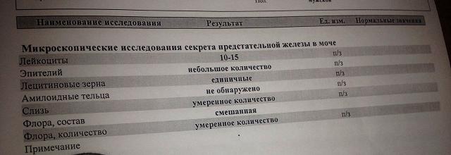 Анализ секрета простаты — подготовка, проведение и стоимость