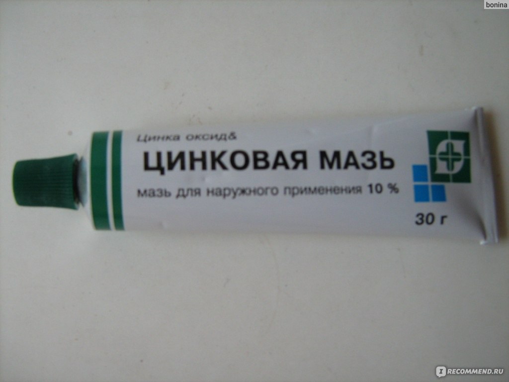 Крем от зуда в интимной зоне: как выбрать аптечный препарат?