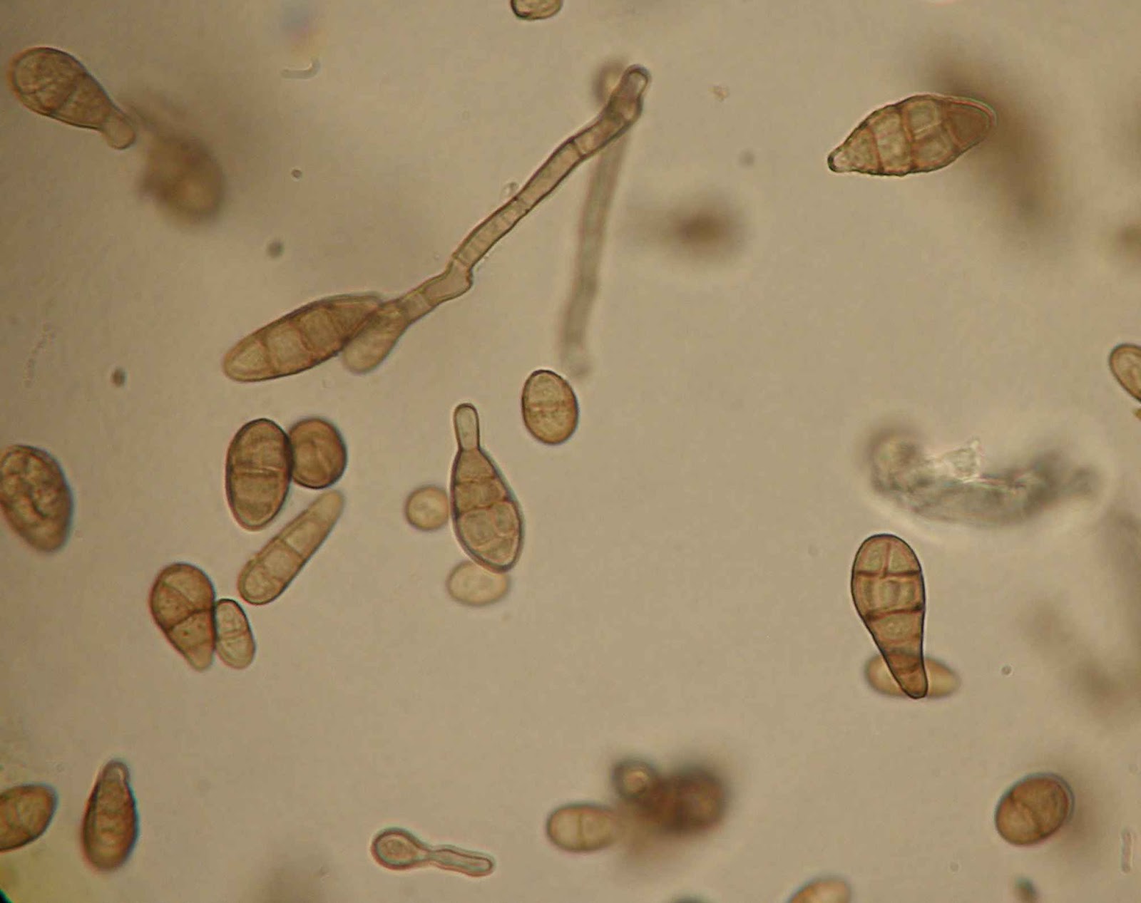 Alternaria alternata- an overview