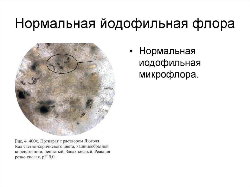 Копрограмма: нормы, расшифровка, правила подготовки
