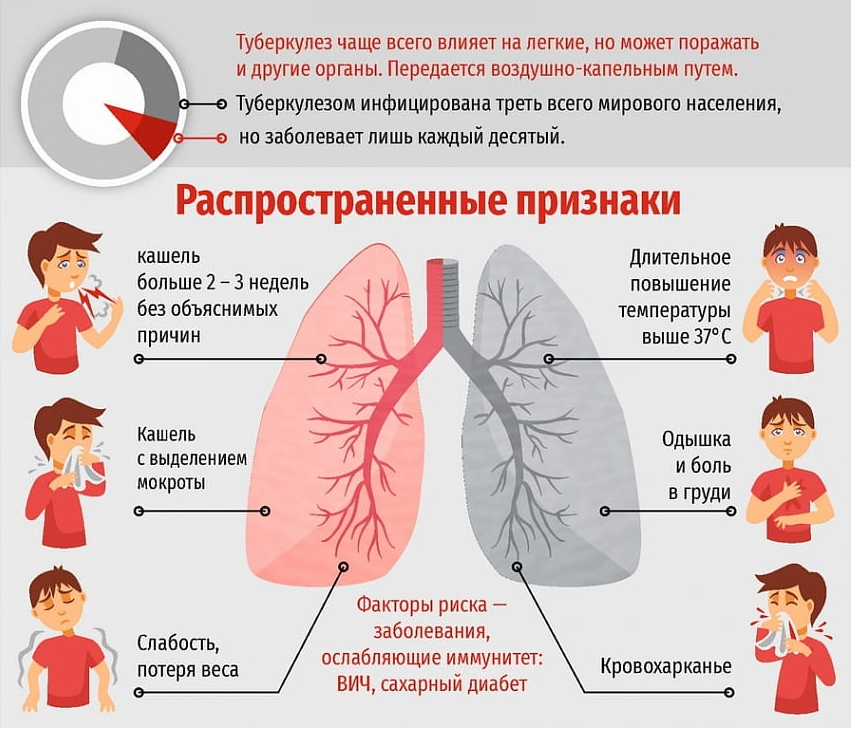 Пневмония у взрослых: симптомы, причины и лечение в домашних условиях
