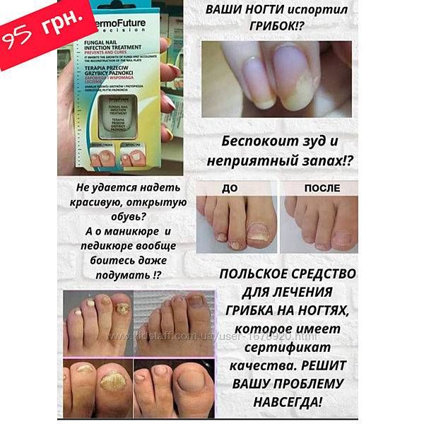 Ванночки для ног от грибка в домашних условиях: эффективные рецепты на основе народных средств | mfarma.ru