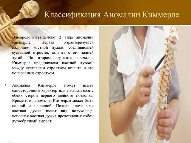 Аномалия (синдром) киммерли - что это такое, 3 опасных последствия