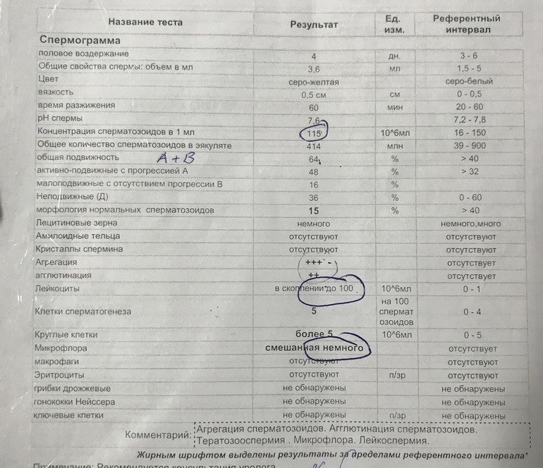Причины повышенной вязкости в спермограмме и как лечить?