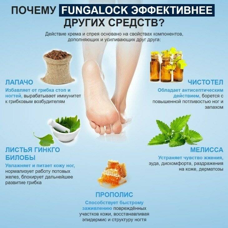 Как лечить грибок стопы в домашних условиях народными средствами - 10 способов