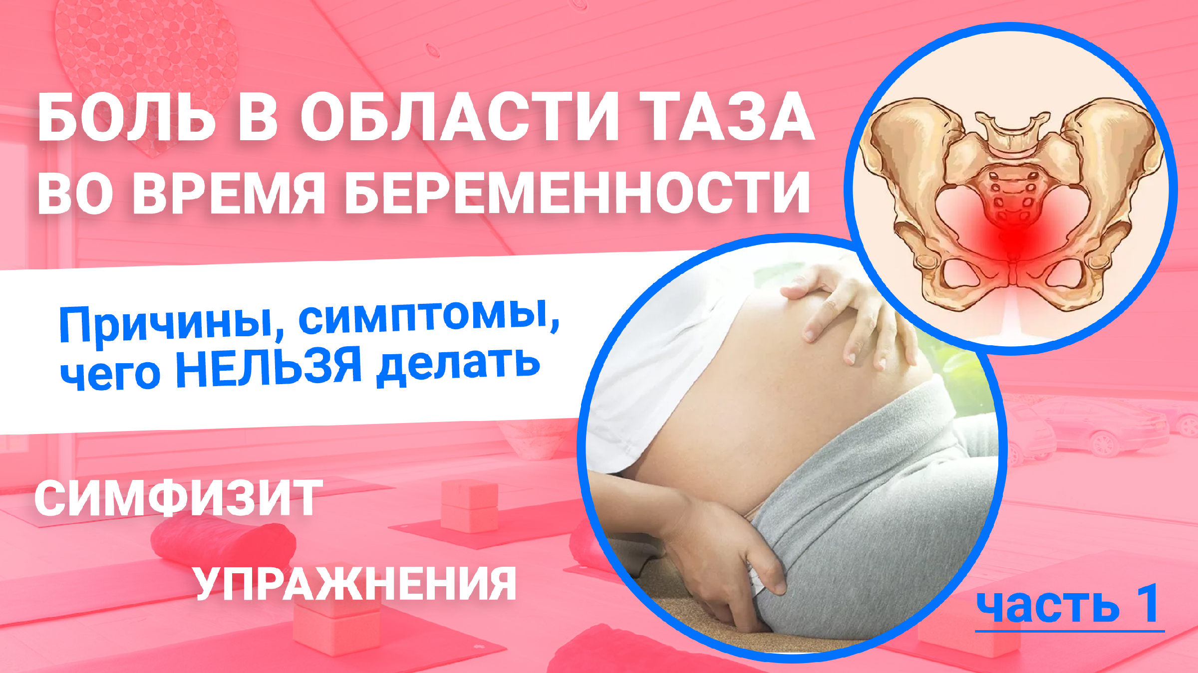 Симфизит при беременности: что это такое, симптомы, расхождение лонного сочленения, влияние на роды, лечение и профилактика