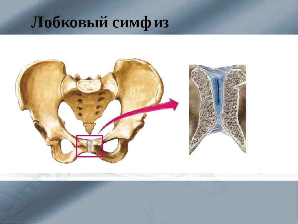 Симфизит: симптомы, причины, лечение