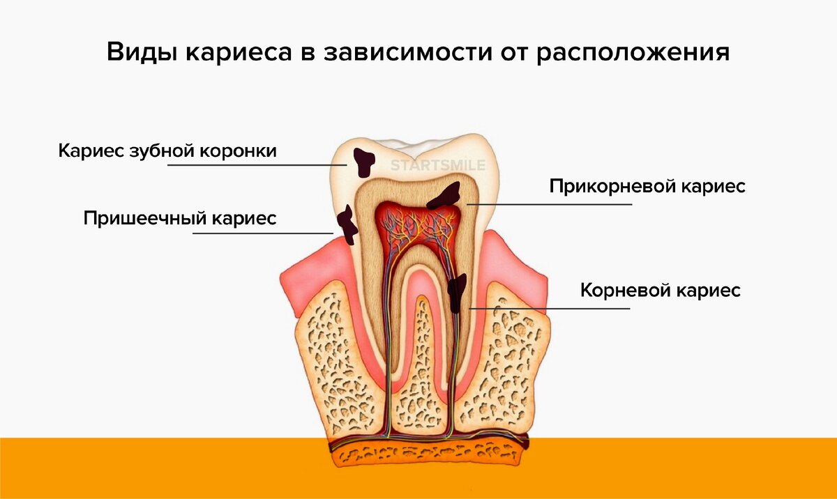 К чему снятся зубы? толкование по 73 сонникам