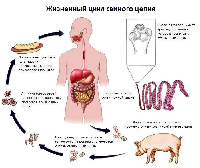 Солитер в рыбе: опасен ли для человека, можно ли есть рыбу зараженную солитером » всё о паразитах человека