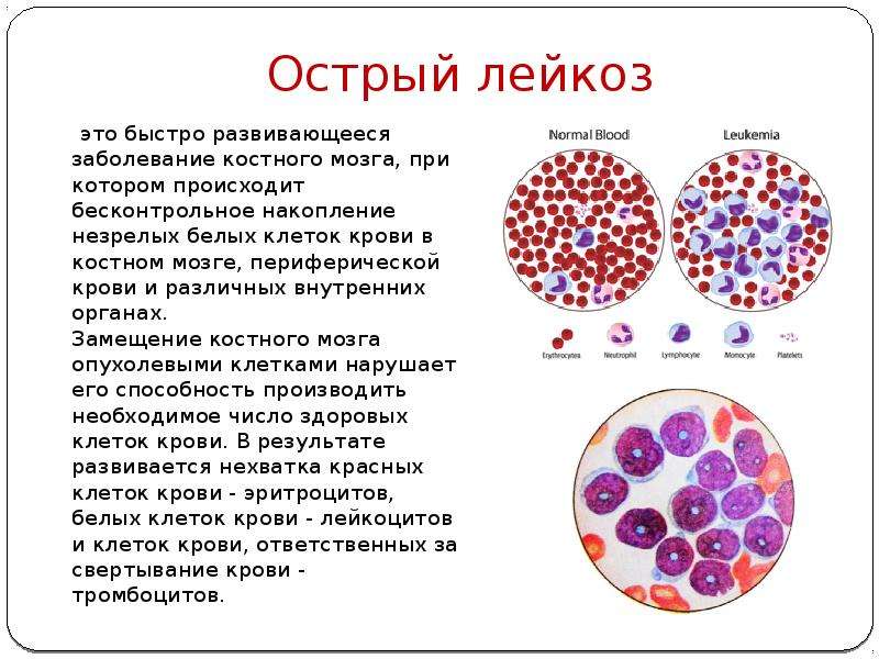Костный мозг