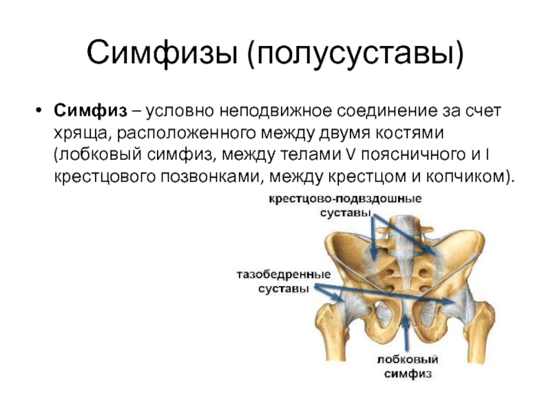 Симфизит при беременности