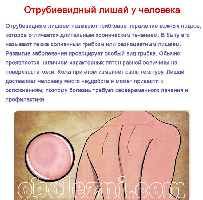 Особенности передачи стригущего лишая от человека к человеку