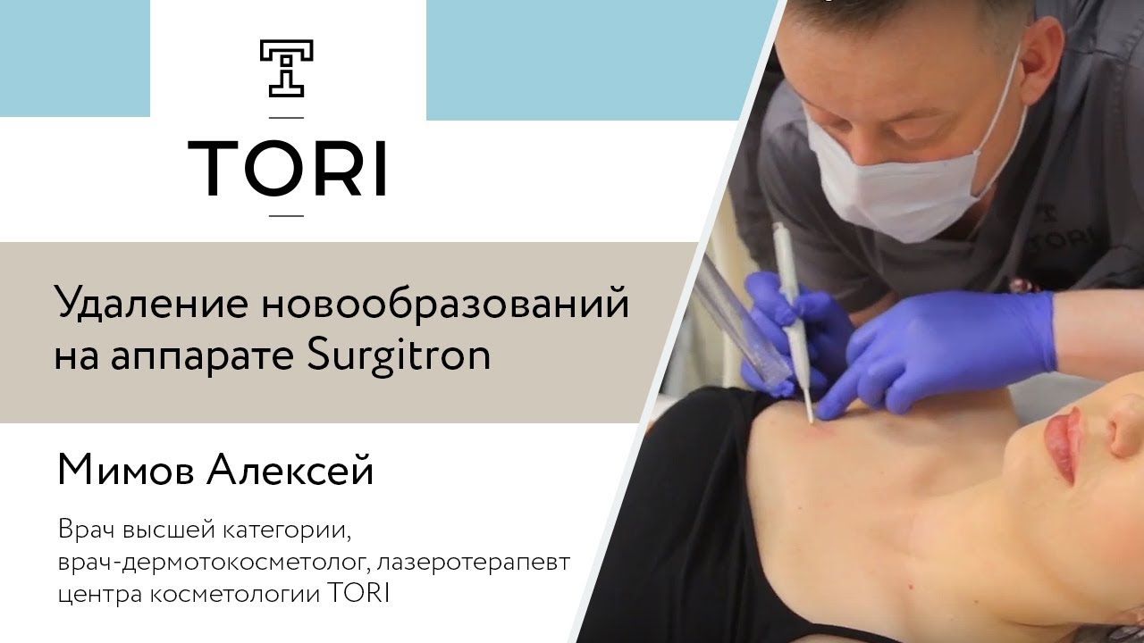 Удаление геморроя сургитроном: показания, минусы