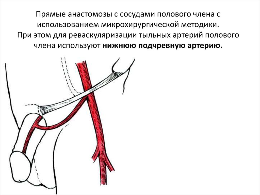 Виллизиев круг: как устроен, норма и аномалии (разомкнут, снижение кровотока), диагностика, лечение