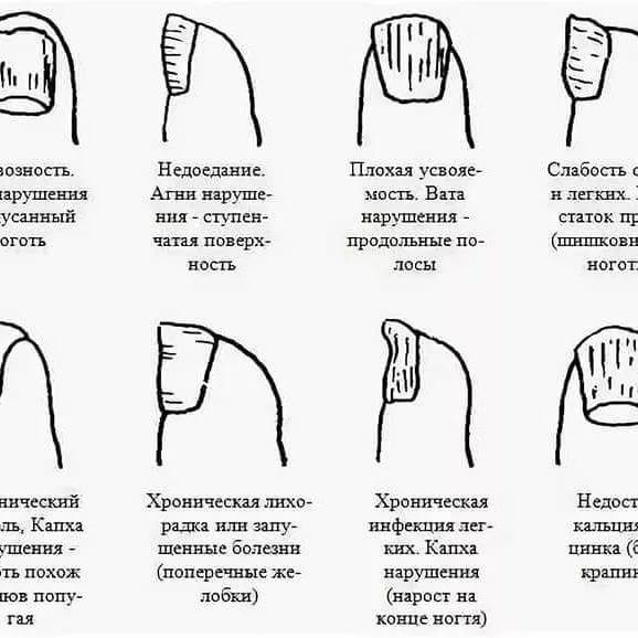 Сухая кожа рук: что делать и как лечить | причины ксероза кожи рук