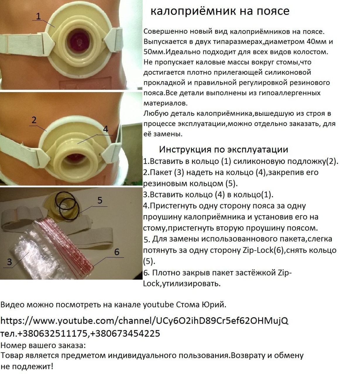 Операция по выведению колостомы