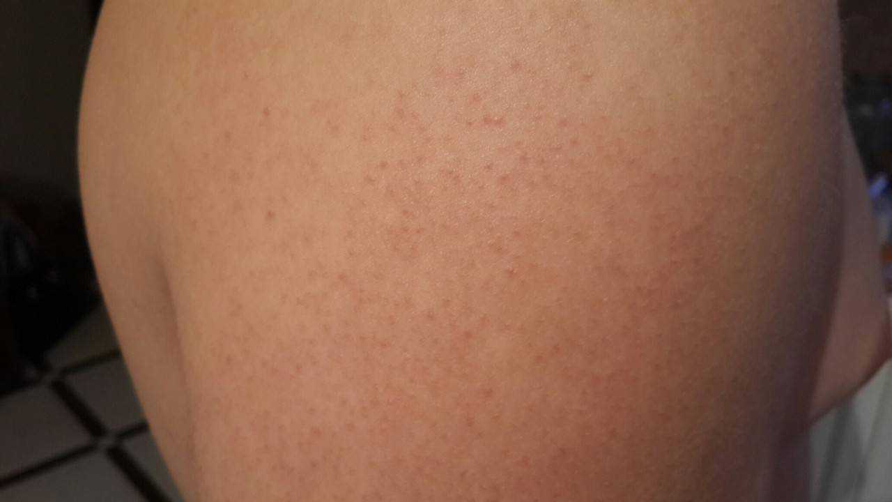 Горят уши – народная примета по дням недели